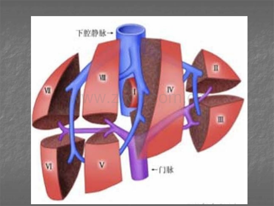 肝未分化肉瘤ppt课件.ppt_第3页