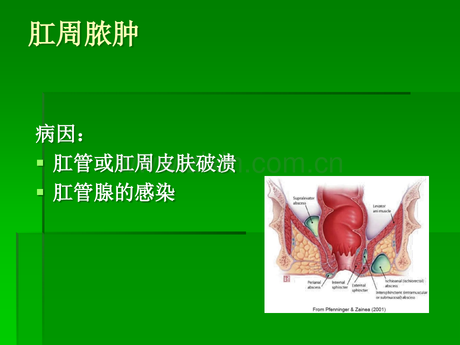 肛瘘课件ppt课件.ppt_第3页