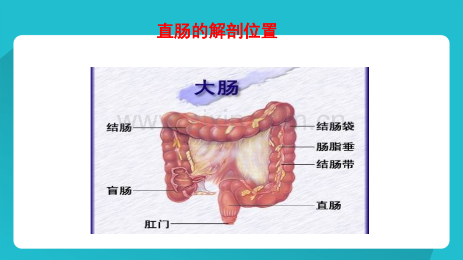 直肠癌护理业务学习.ppt_第3页