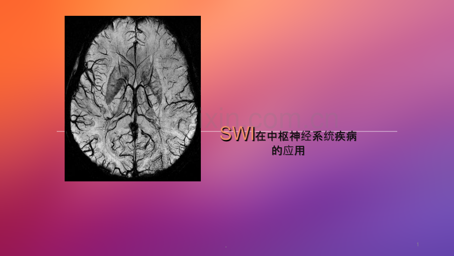 SWI在中枢神经系统应用ppt课件.ppt_第1页