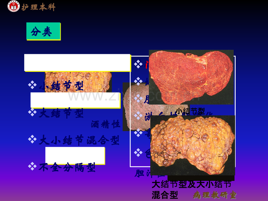 病理学肝硬化肝癌ppt课件.ppt_第3页