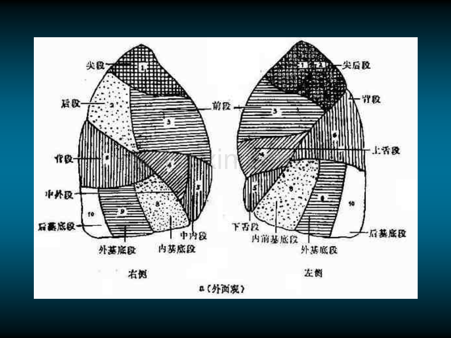 肺的X线解剖.ppt_第3页