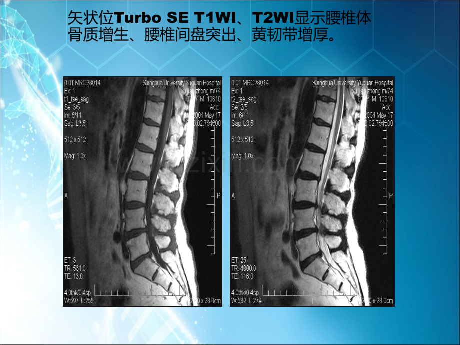 MRI学习ppt课件.ppt_第2页