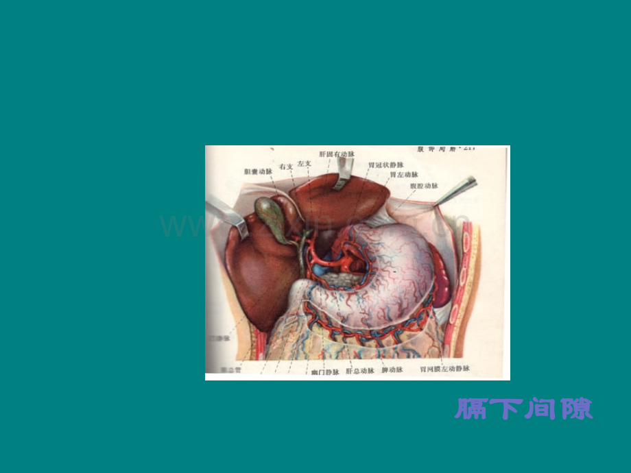 腹腔脓肿的诊断及治疗ppt课件.ppt_第2页