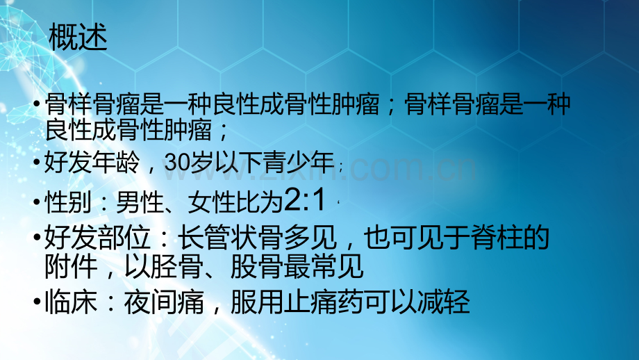 骨样骨瘤病例诊断与鉴别诊断ppt课件.pptx_第2页