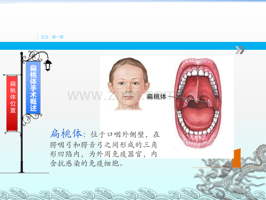 扁桃体术后指导ppt课件.pptx_第3页