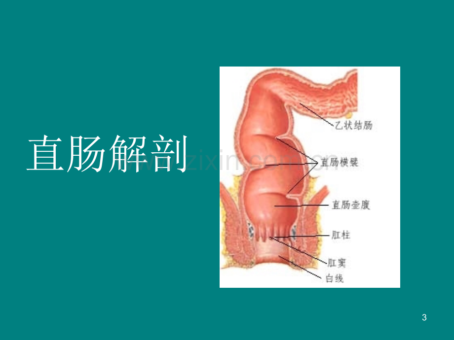 直肠癌查房-PPT课件.ppt_第3页