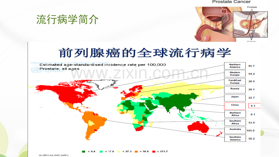 腹腔镜前列腺癌根治术ppt课件.ppt_第2页