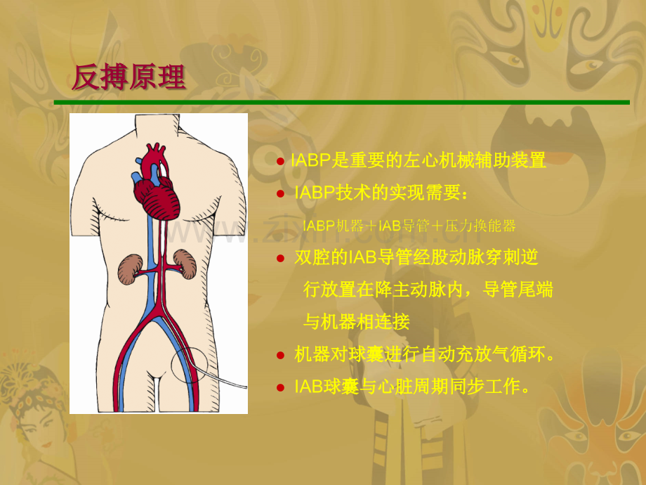 IABAuoca-ppt课件.ppt_第3页