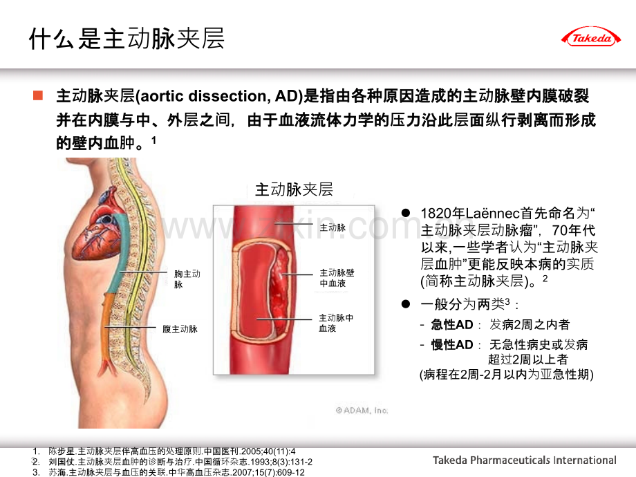 主动脉夹层临床管理策略ppt课件.pptx_第3页