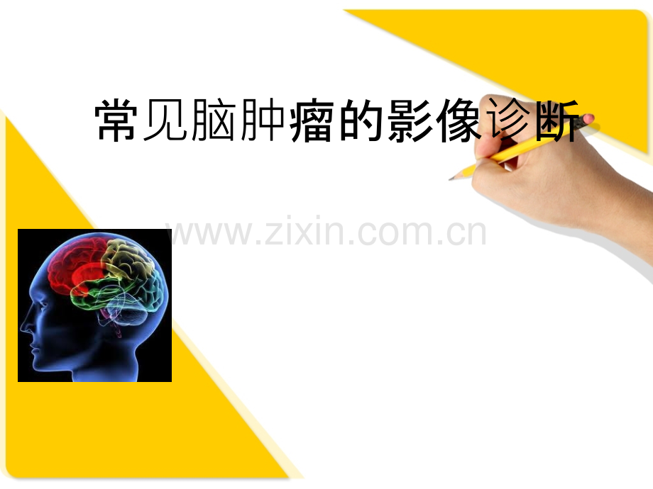 常见脑肿瘤的影像诊断.ppt32081.ppt_第1页