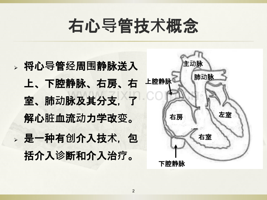 右心导管检查及心血管造影PPT课件.ppt_第2页