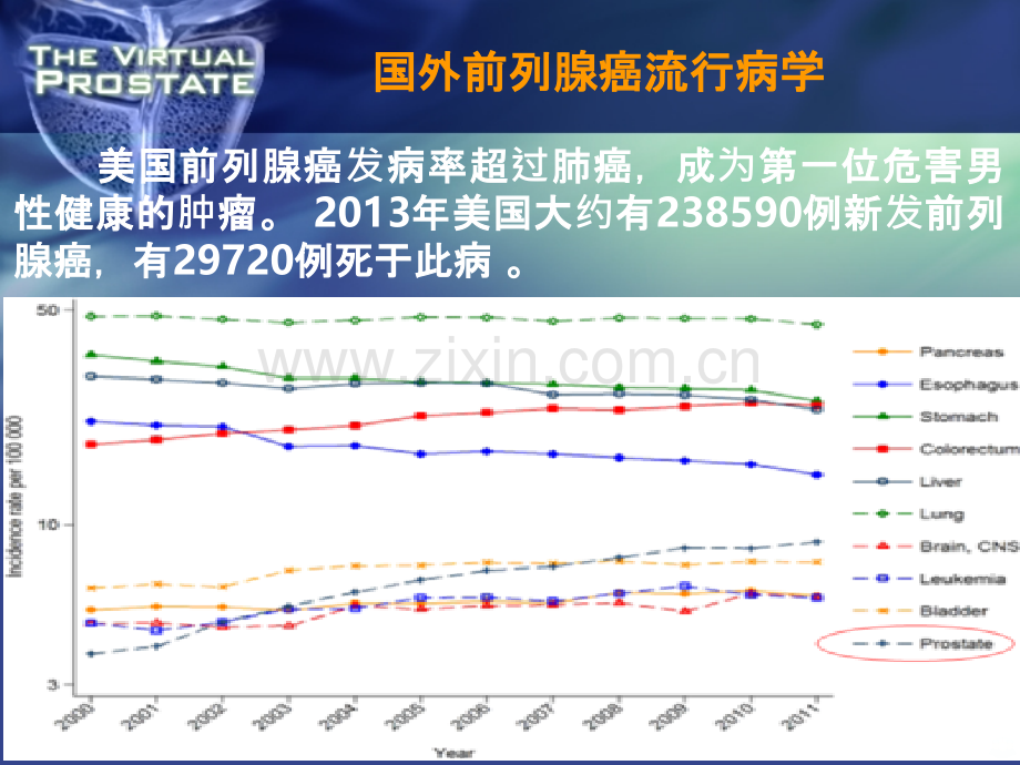 张广涛----前列腺癌诊疗新进展PPT课件.ppt_第3页