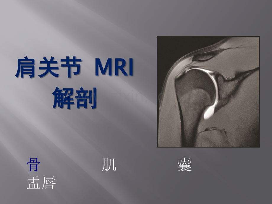 肩关节病变MRI(骨科)ppt课件.pptx_第3页