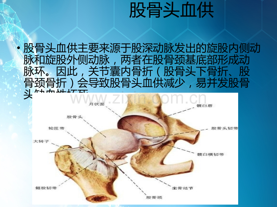 股骨头缺血坏死性ppt课件.pptx_第2页