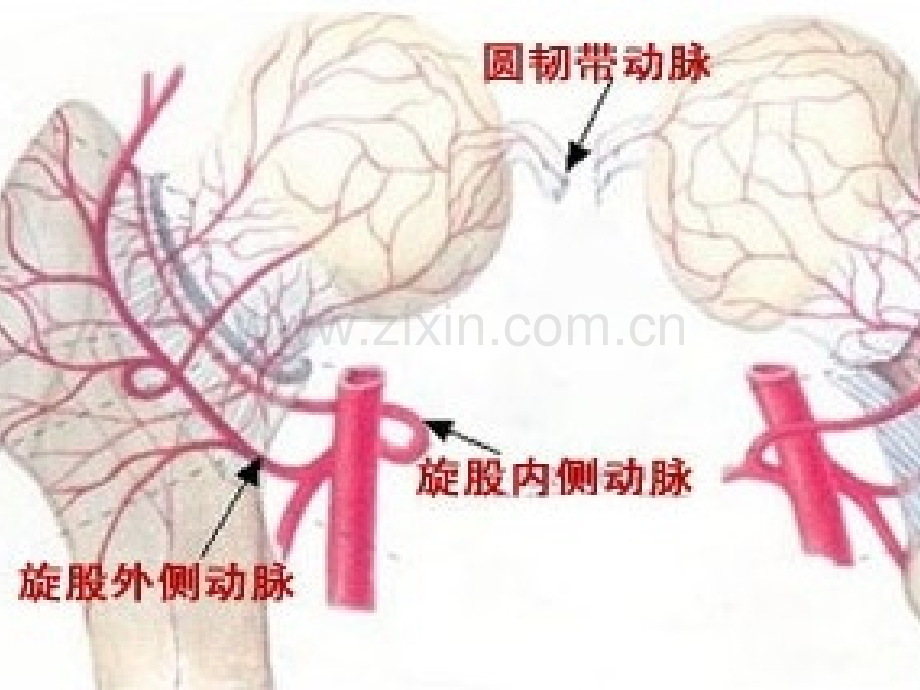 股骨头缺血坏死性ppt课件.pptx_第3页