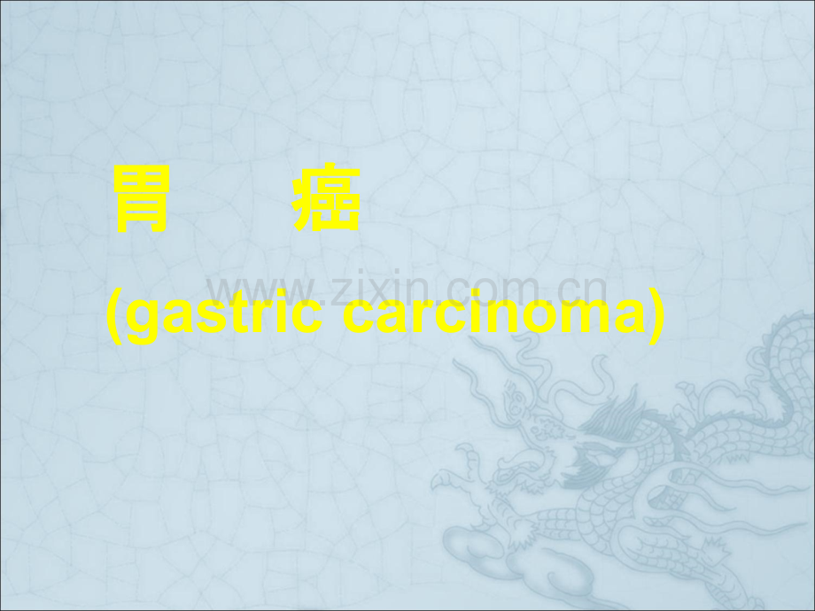 胃癌幻灯.ppt_第1页