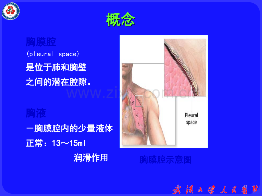 胸腔积液患者的护理.ppt_第3页