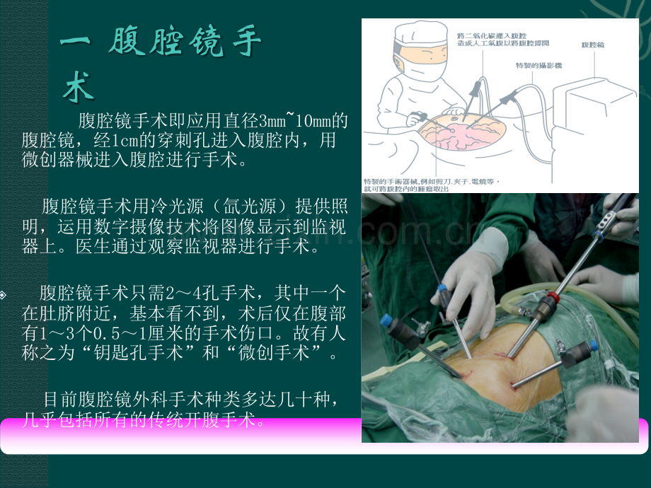 腹腔镜的操作标准.ppt_第3页