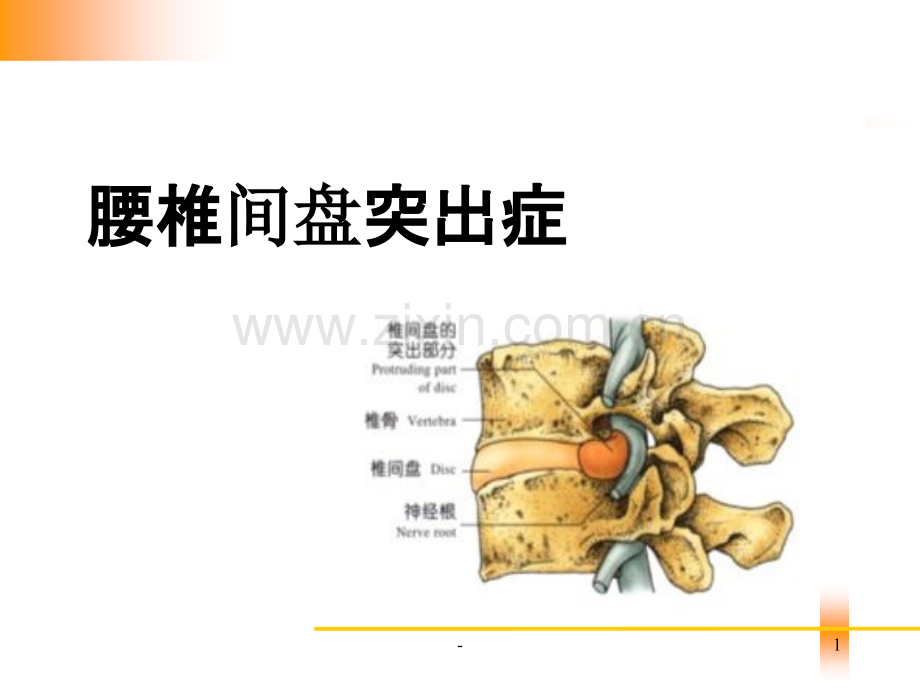 腰椎间盘突出症病人的护理PPT课件.ppt_第1页