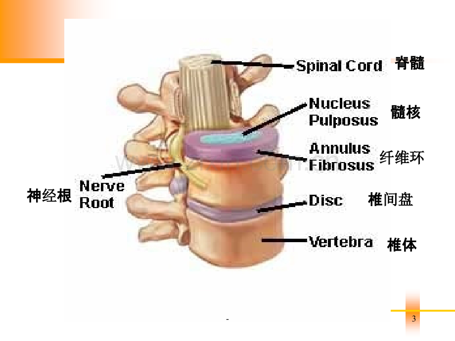 腰椎间盘突出症病人的护理PPT课件.ppt_第3页