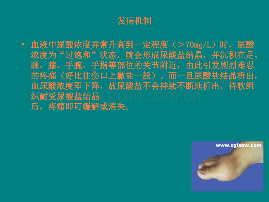 痛风与贫血的营养治疗.ppt_第3页