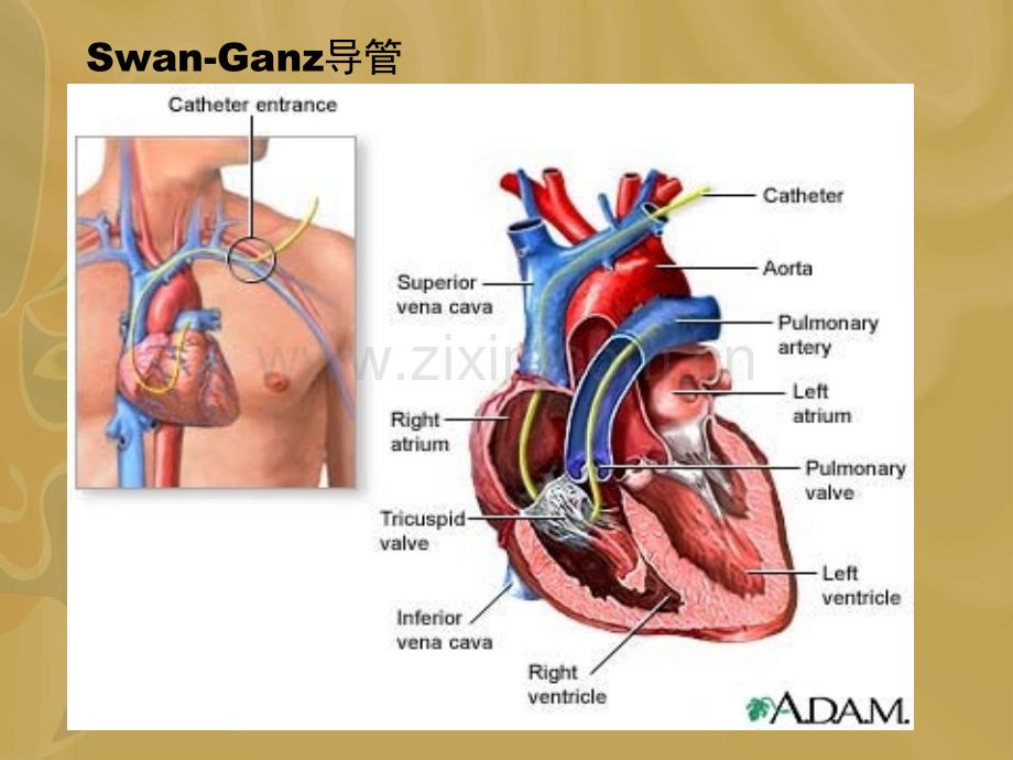 iCCO培训ppt课件.ppt_第3页