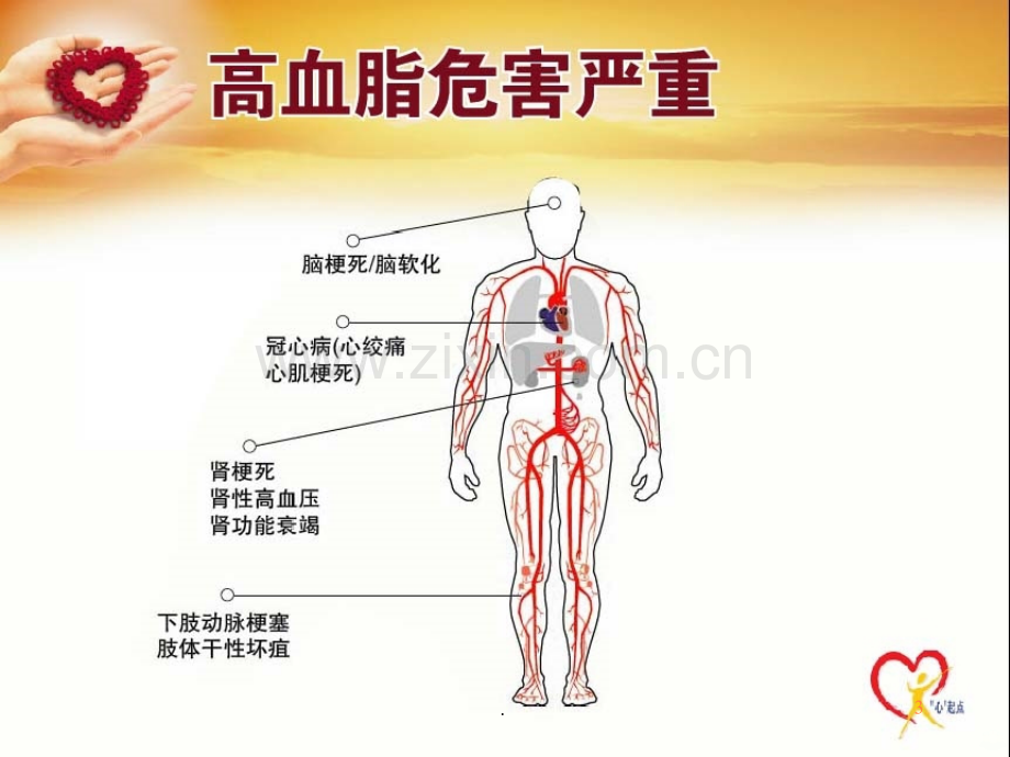 g关注高血脂ppt课件.ppt_第3页