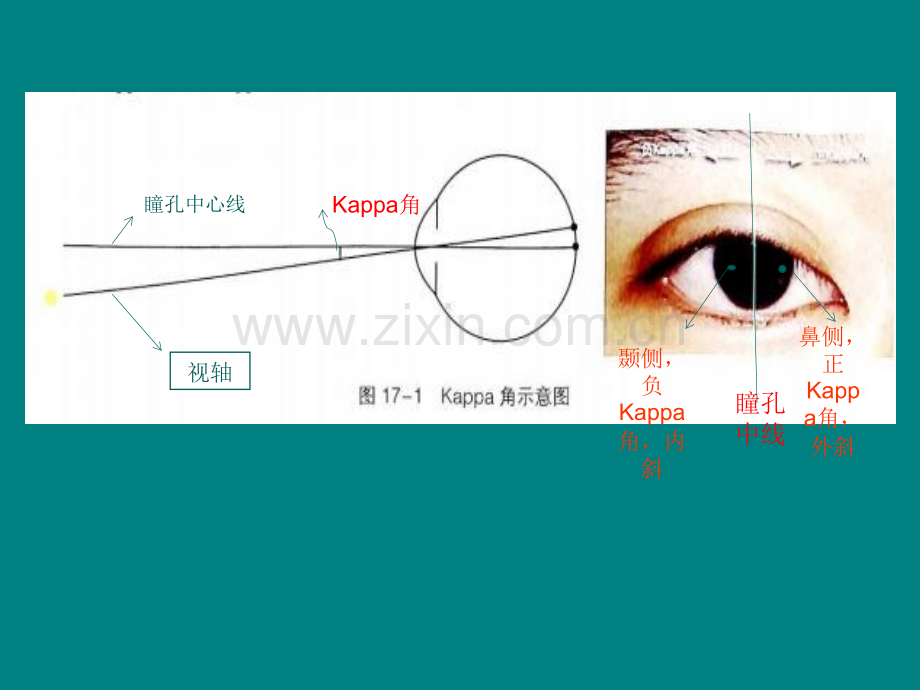 斜视几个概念.ppt_第3页