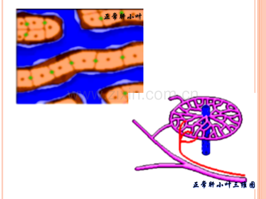 病毒性肝炎的护理与治疗.ppt_第3页