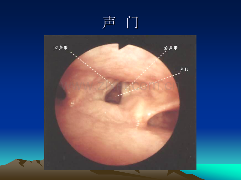 纤维支气管镜图谱.ppt_第2页