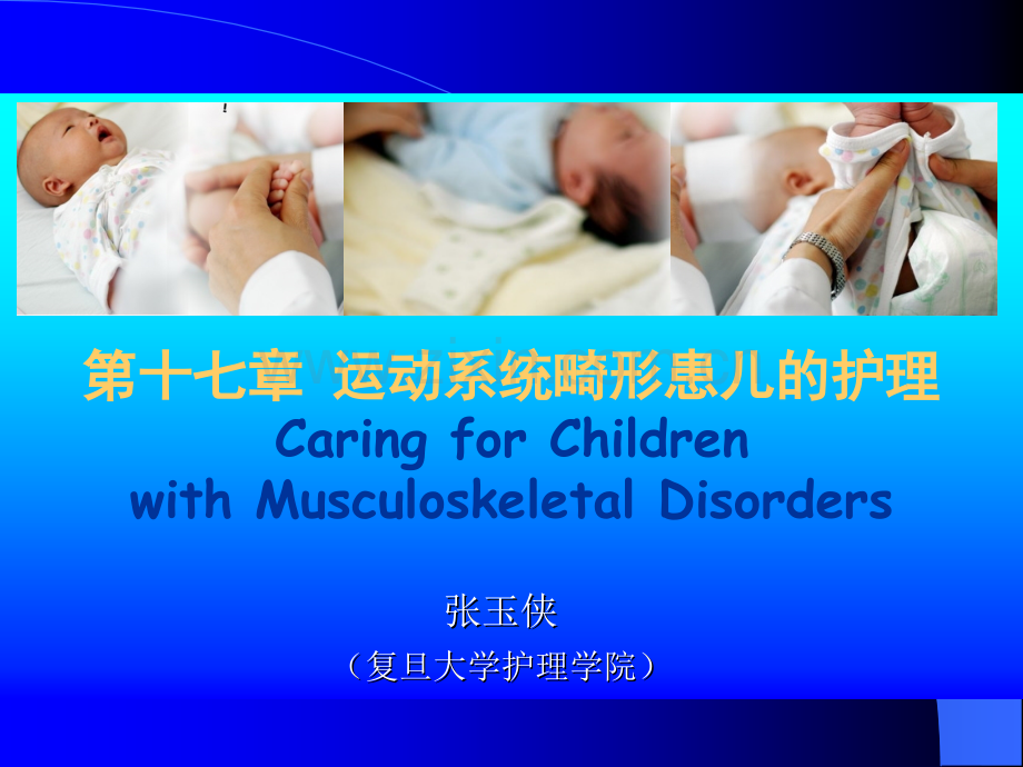 儿科护理学运动系统畸形患儿的护理ppt课件.ppt_第2页