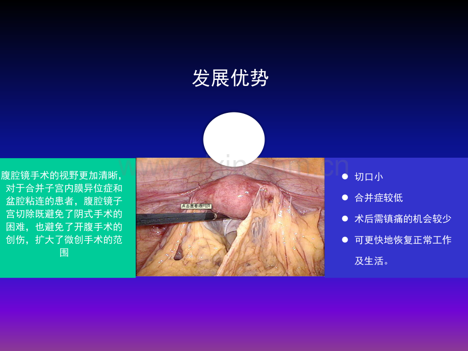 腹腔镜下全宫切护理查房ppt课件(1).pptx_第3页