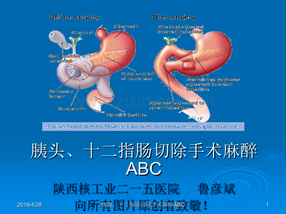 胰腺、十二指肠手术麻醉ABC--鲁彦斌ppt课件.pptx_第1页