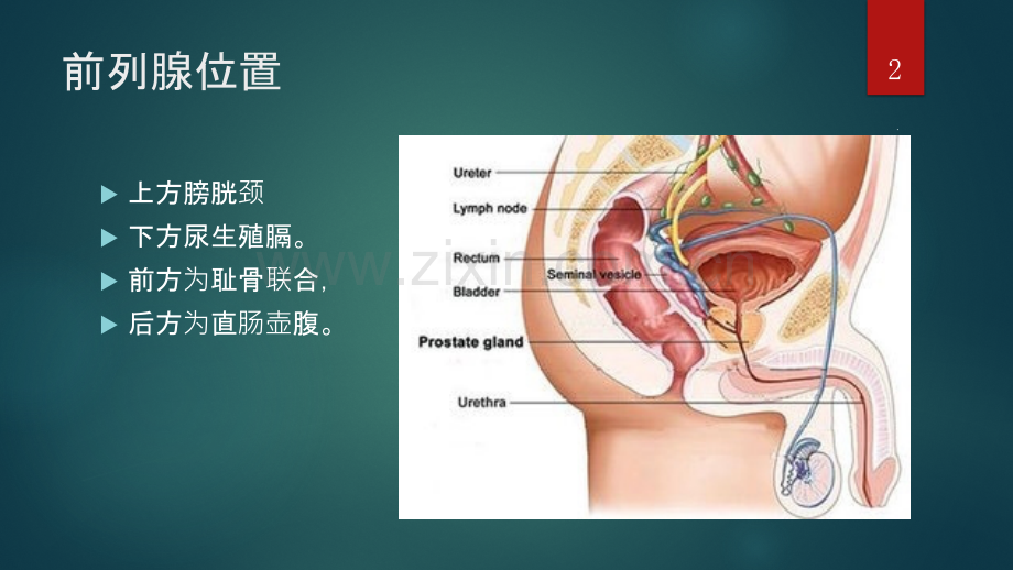 BPH手术指征ppt课件.pptx_第2页