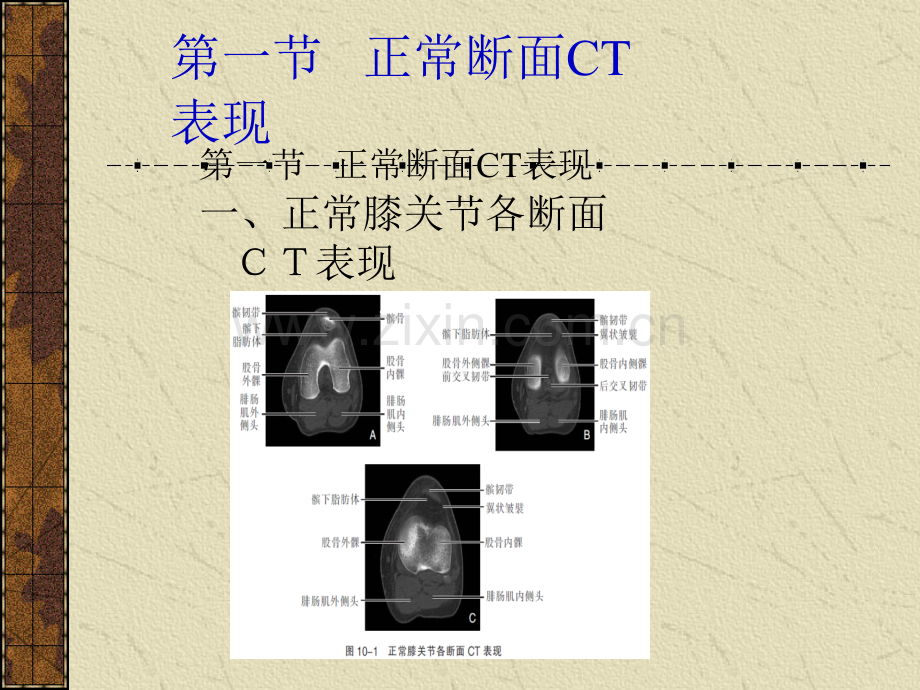 第十章-运动系统.ppt_第2页