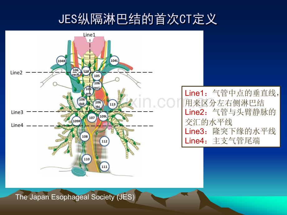 食管癌放疗靶区中国建议ppt课件.pptx_第3页