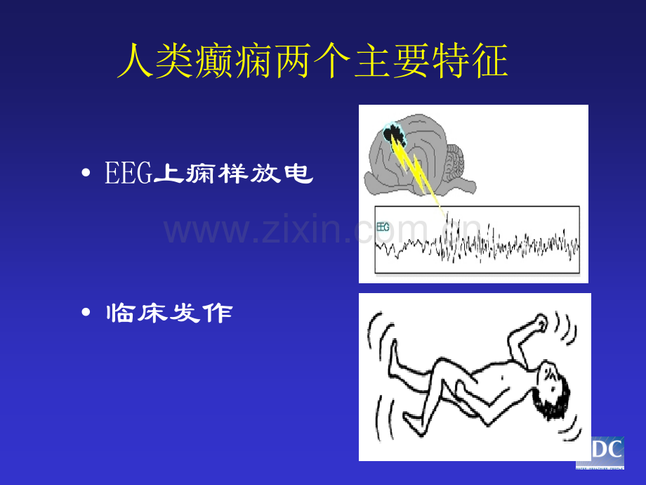 癫痫发作的鉴别诊断ppt课件.ppt_第2页