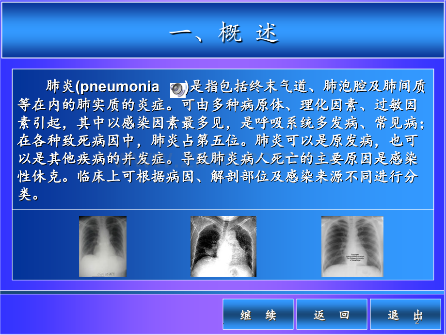 7、肺炎PPT课件.ppt_第2页