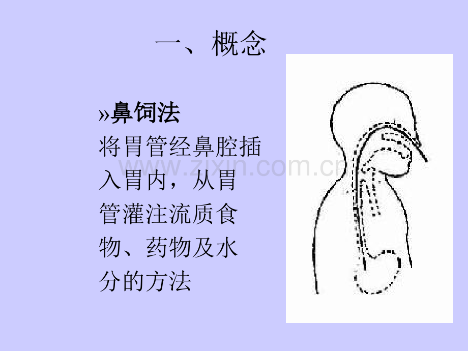 鼻饲法操作ppt课件.ppt_第3页