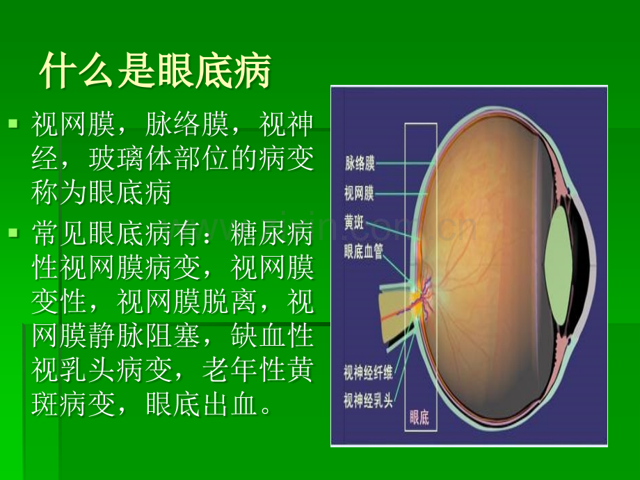 复方血栓通胶囊眼科幻灯片--基药ppt课件.ppt_第3页