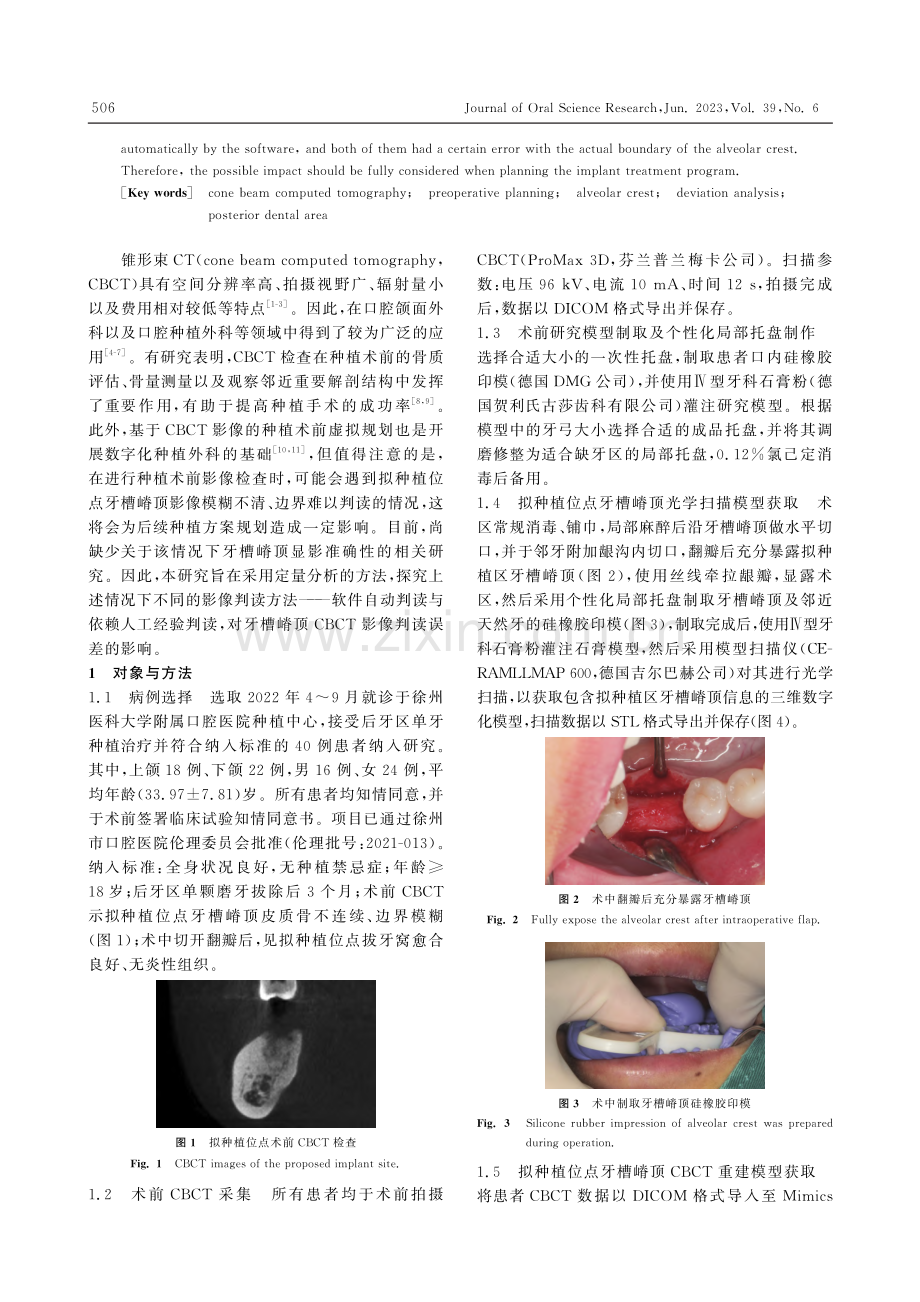 探究后牙区拟种植位点牙槽嵴顶CBCT影像的判读误差_刘亚.pdf_第2页