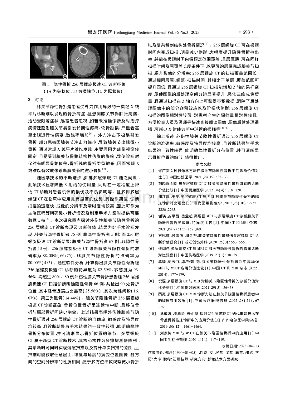 外伤性膝关节隐性骨折的25...CT诊断表现及诊断价值研究_郑丹.pdf_第3页