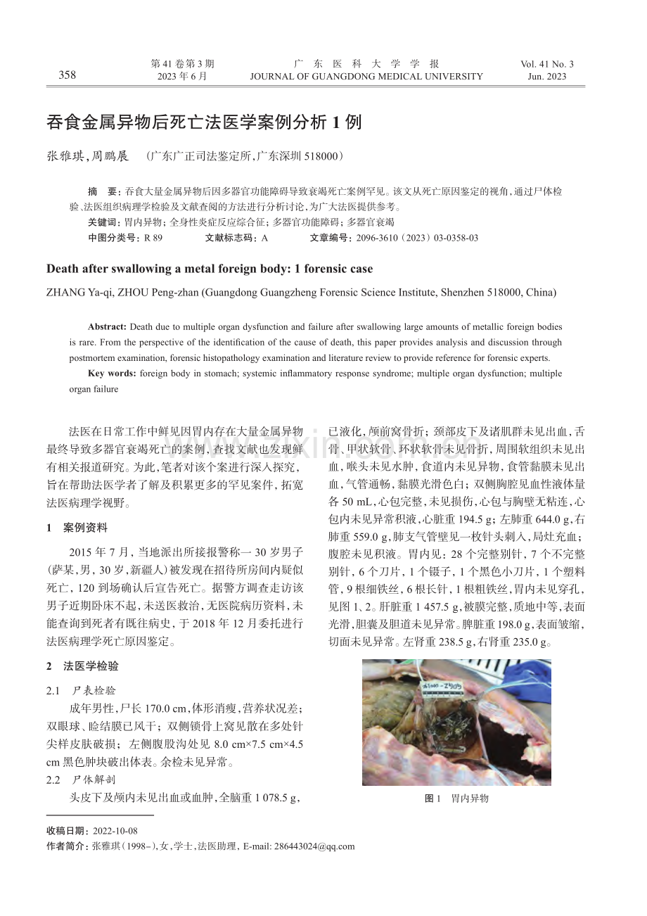 吞食金属异物后死亡法医学案例分析1例_张雅琪.pdf_第1页