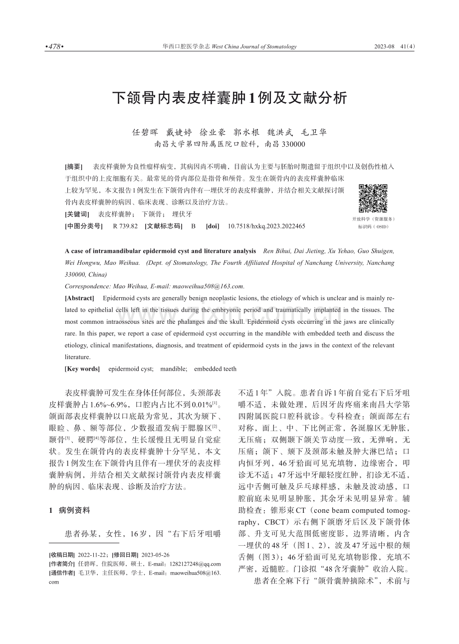 下颌骨内表皮样囊肿1例及文献分析.pdf_第1页