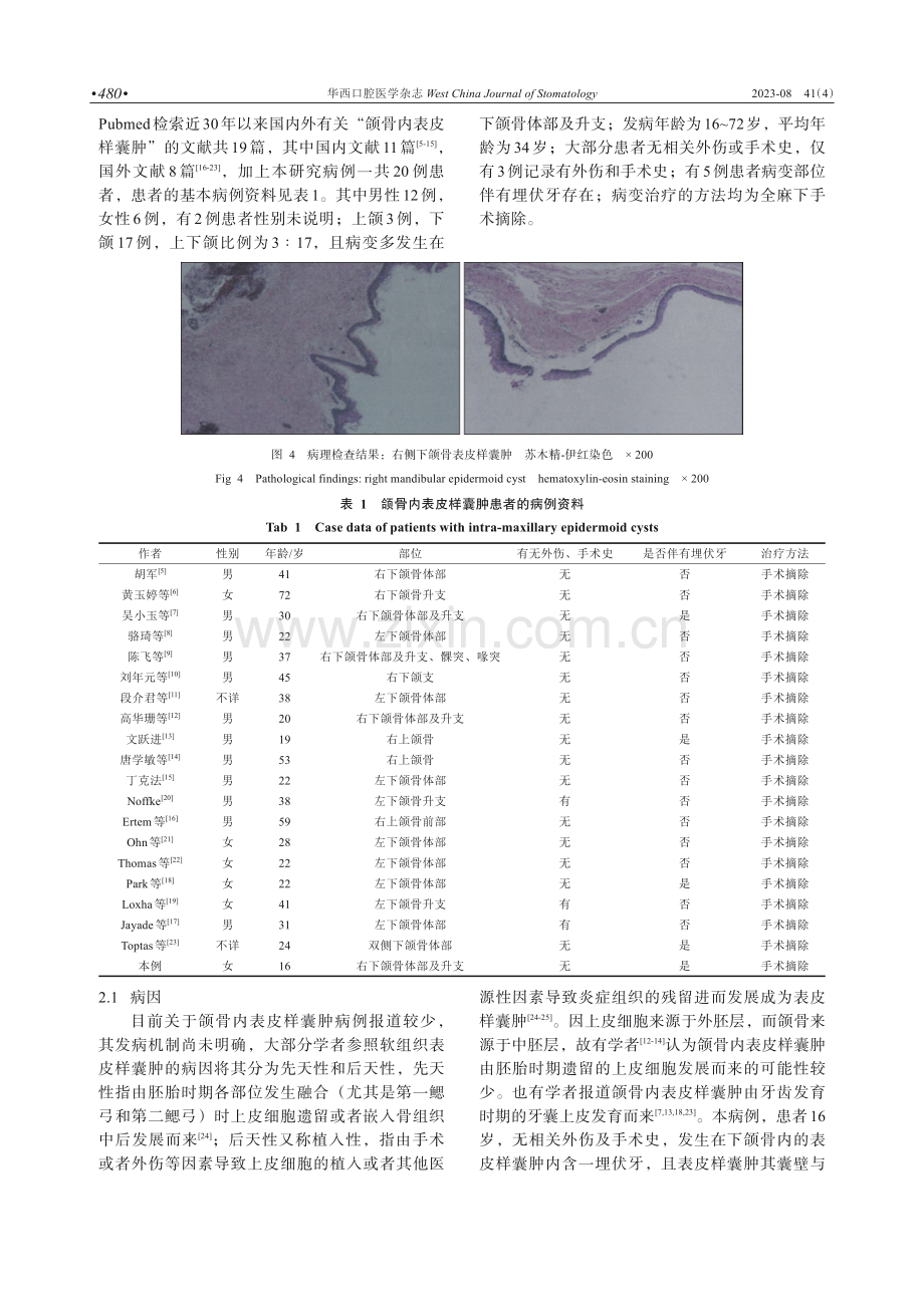 下颌骨内表皮样囊肿1例及文献分析.pdf_第3页