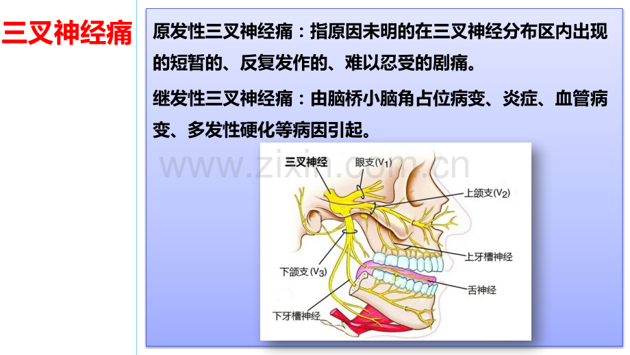 三叉神经痛病人的护理课件.pptx_第1页