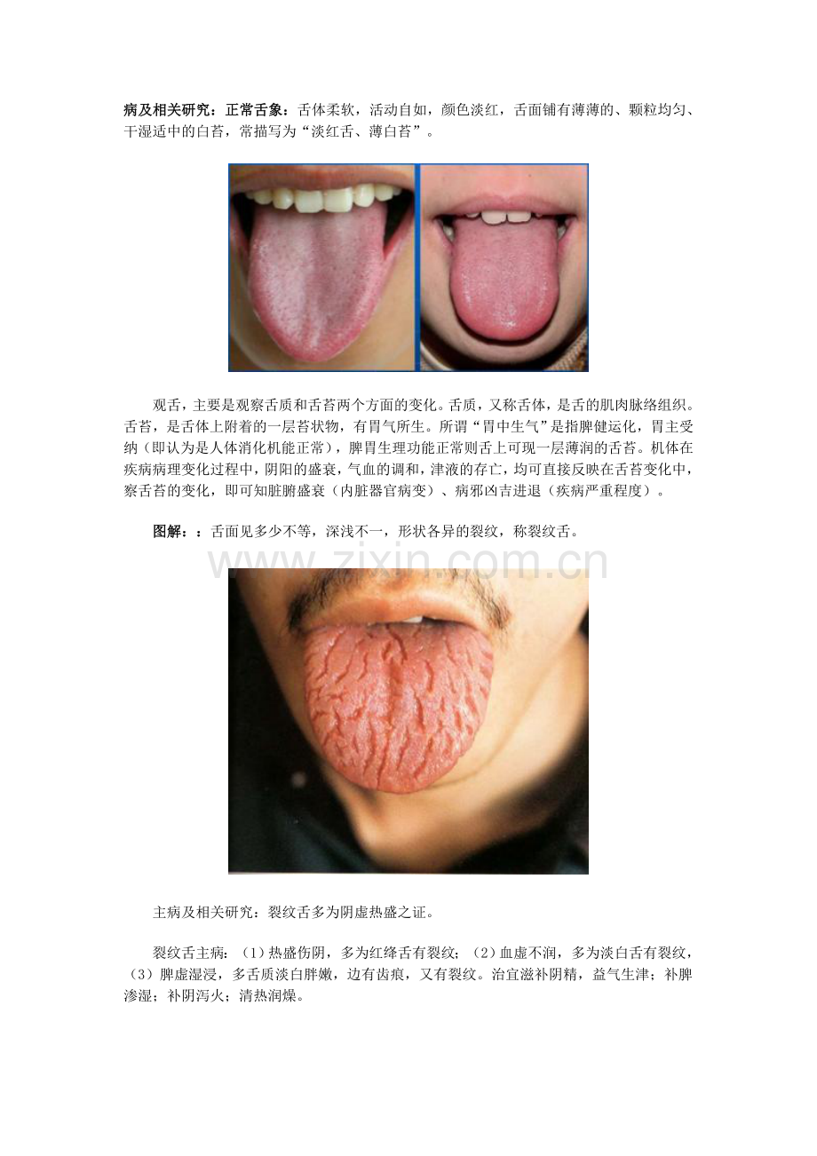 舌诊实例图解.doc_第1页