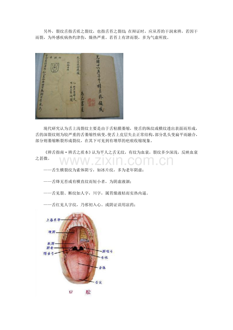 舌诊实例图解.doc_第2页