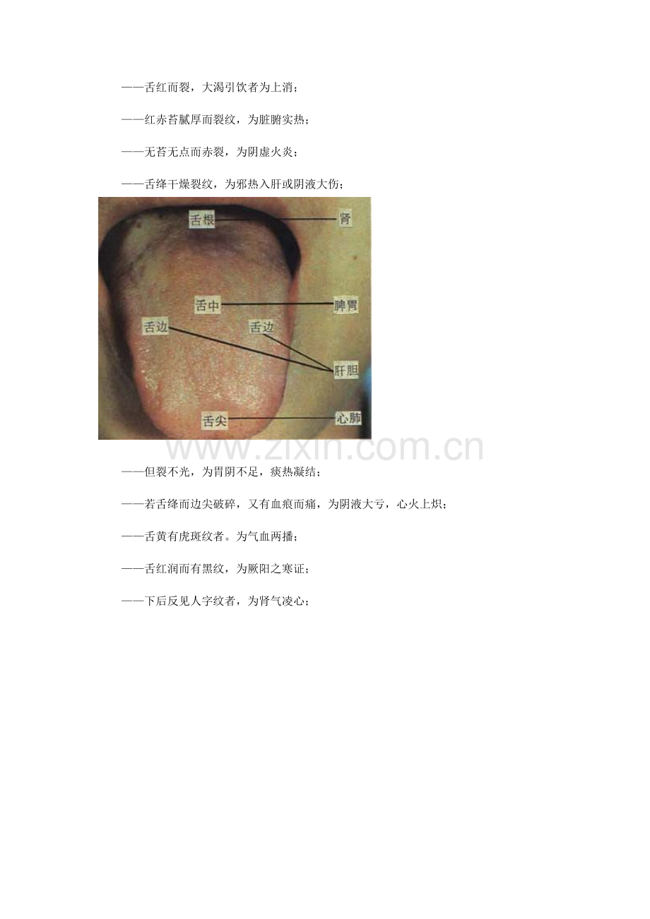 舌诊实例图解.doc_第3页